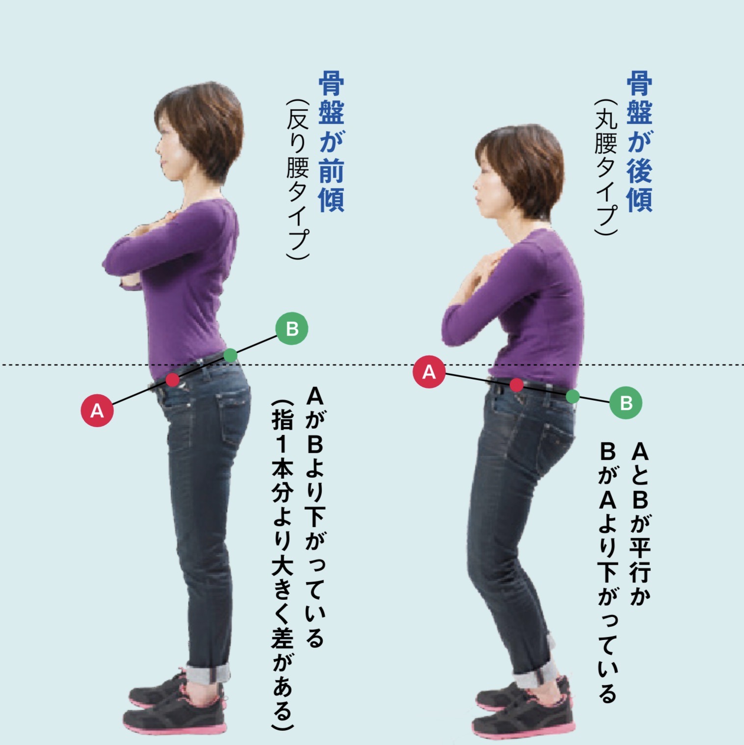 骨盤が正しい位置ではない女性のイメージ（骨盤が前傾で反り腰になっている女性と、骨盤が後傾で腰が丸くなってしまっている女性）